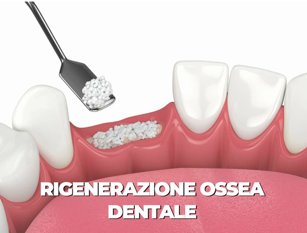 Immagine trattamento 3